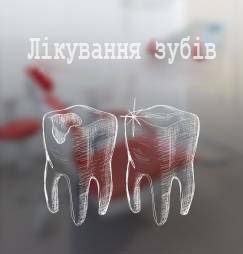 лікування зубів у стоматологічній клініці СityDent на Осокорках та Позняках