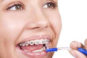 Стоматологічна клініка CityDent - зубне протезування, Професійна гігієна зубів Ультразвук, Air-flow