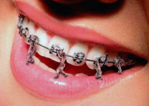 Стоматолог-ортодонт. Когда начинать лечение? Ортодонтия для взрослых