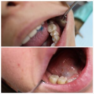 Портфолио стоматологических - Клиника CityDent на Позняках